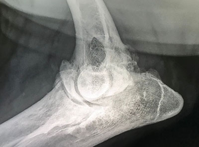 elbow x ray large