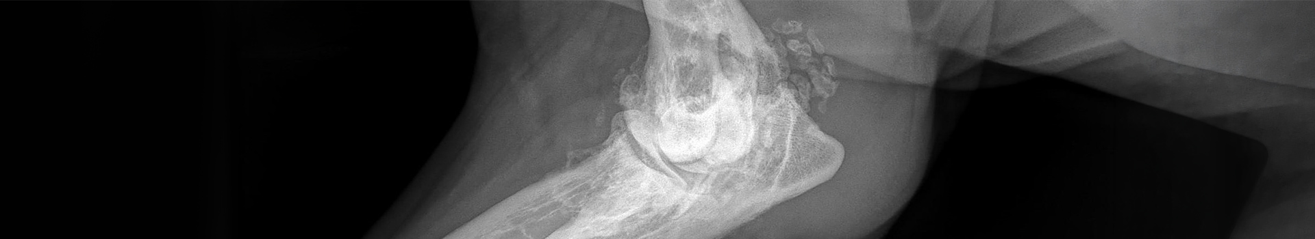 Emerging Signs of Rapidly Progressive Arthritic Changes in Dogs and Cats Receiving Bedinvetmab and Frunevetmab
